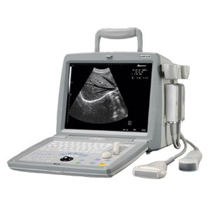 Ultrasound Diagnostic