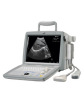 Ultrasound Diagnostic Device