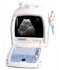 Ultrasound Diagnostic Device