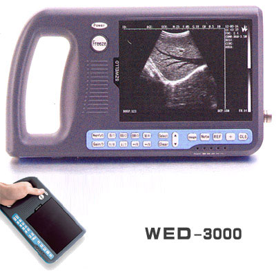 Ultrasound Scanner