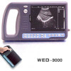 (PalmSmart) Ultrasound Scanner