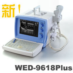 Ultrasound Scanner