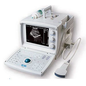 Portable Ultrasound Scanner