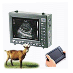 PalmTop Ultrasound Scanner