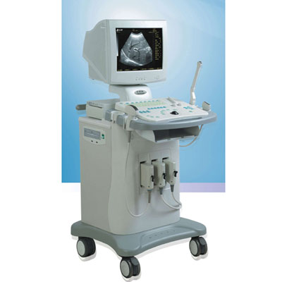 digital ultrasonic diagnostic system