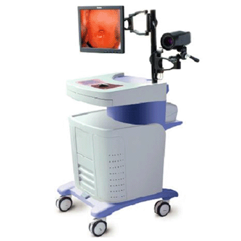 Specialized Digital Colposcope