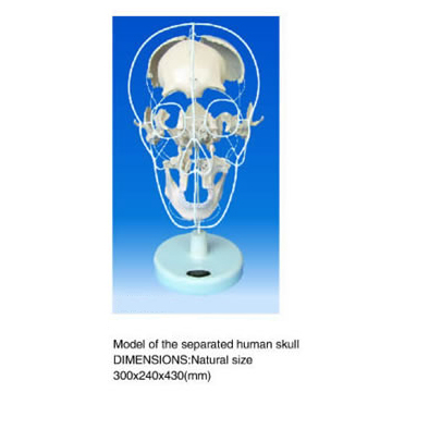 separated human skull