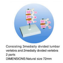 Consisting 3medially Divided Lumbar Vertebra