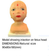 fetus heads