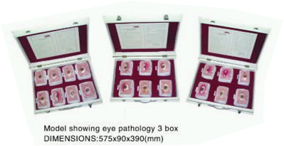 Model Showing Eye Pathology 3 Box