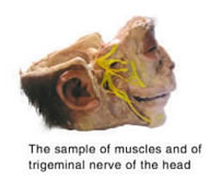 trigeminal nerve