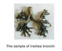 The Sample Of Trachea Bronchi