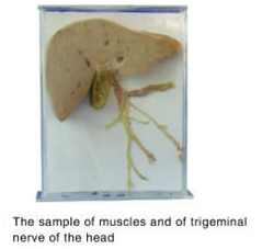 trigeminal  nerve