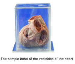 The Sample Base Of The Ventricles Of The Heart