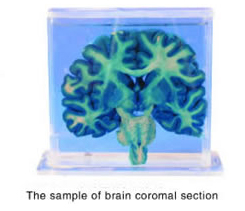 brain coronal section