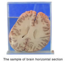 horizontal section