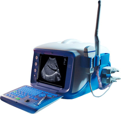 Ultrasound  Scanners