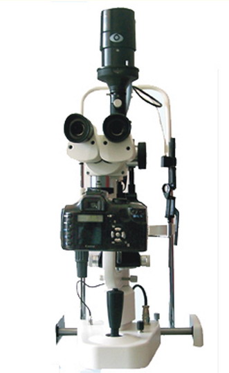 Digital Slit Lamp Microscope