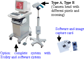 Video Colposcope