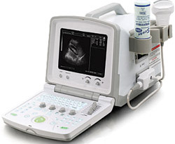 Portable Ultrasound Scanner