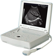 laptop ultrasound diagnostic equipment