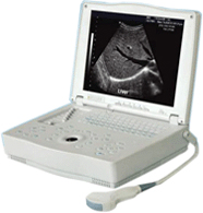 Laptop type Ultrasound Diagnostic Equipment