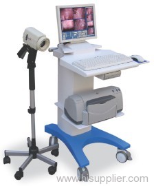 Colposcope Medical Equipment