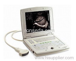 Full digital laptop ultrasound scanner