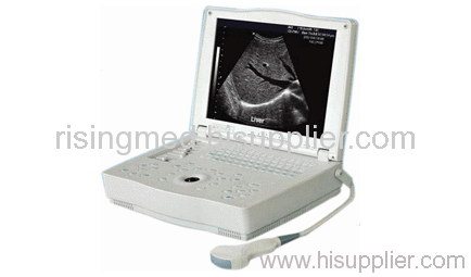 digital ultrasound scanner