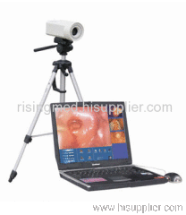 Electronic Colposcope