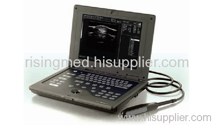 medical ultrasound Scanner