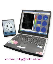 Digital EEG System