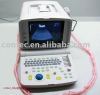 Portable Ultrasound Scanner----CE Approved Ultrasound Machine