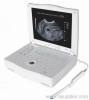 Laptop Ultrasound Scanner RSD-RP6A