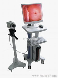 Digital Video Colposcope