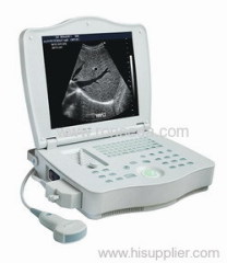 notebook ultrasound scanners