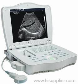 Digital Laptop Ultrasound Scanner RSD-RP6A Plus
