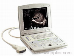 Laptop Veterinary Ultrasound Scanner RSD-RD8B VET
