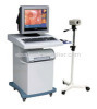 Digital video colposcope