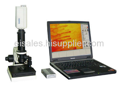 Microcirculation Analyzer