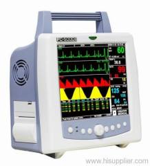 Multi-parameter Patient Monitor