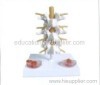extruded disk model