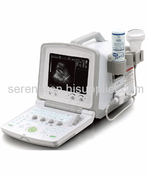 Portable Ultrasound Scanner