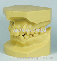 jaw model