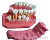 silicon rubber gingiva