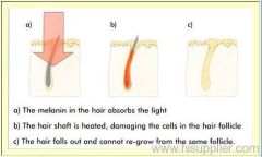 Best Derma Laser