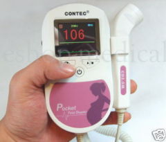 fetal doppler