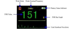 fetal doppler