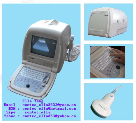 b ultrasound scanner