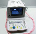 B Ultrasound Scanner